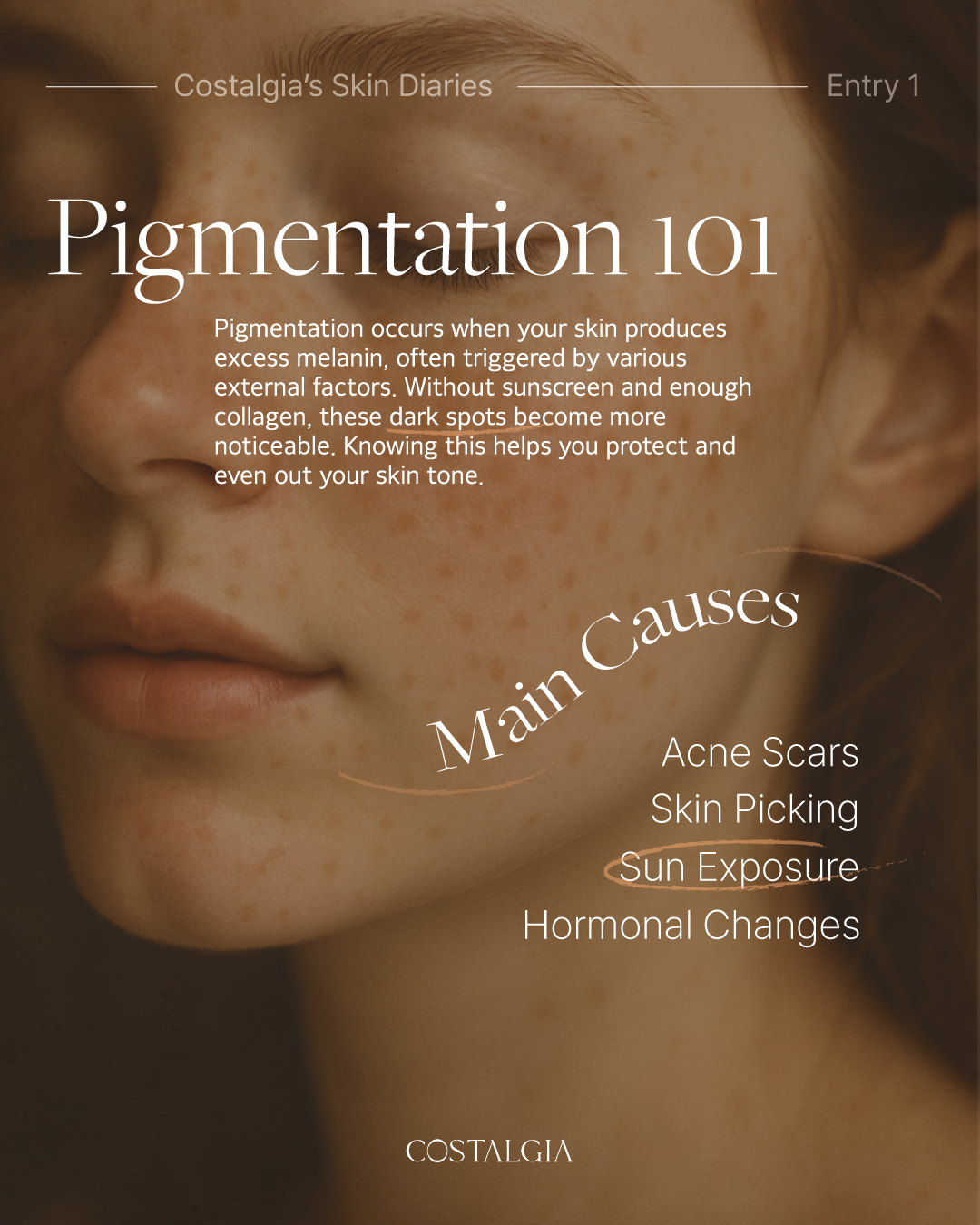 Costalgia’s Skin Diaries — Entry 1: Pigmentation 101